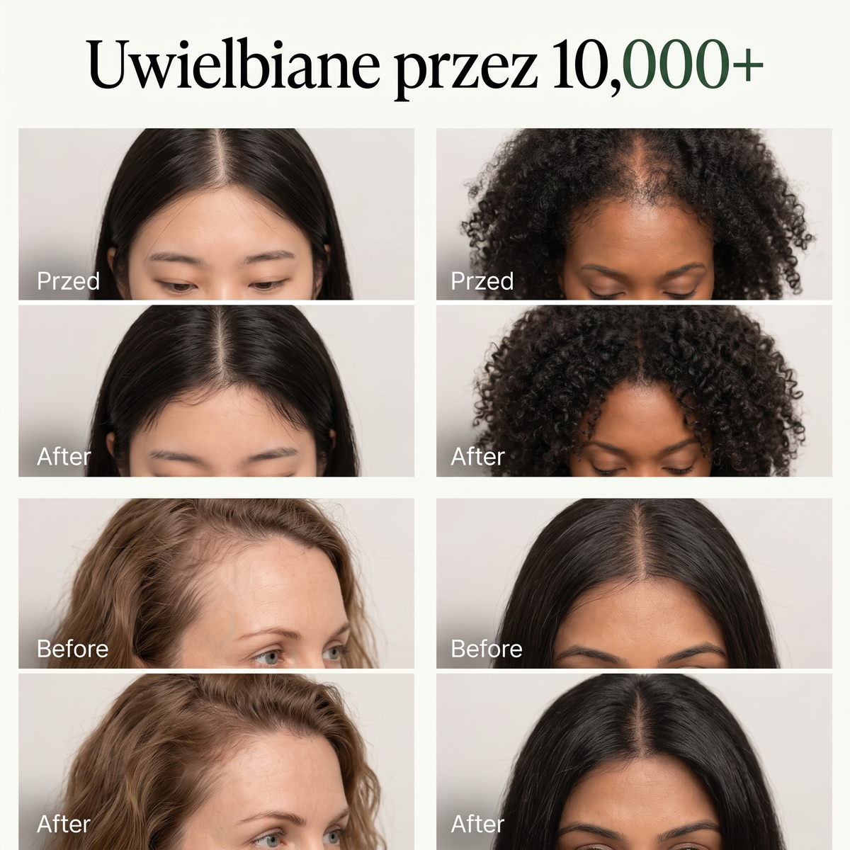 Korean Scalp Renewal Bar